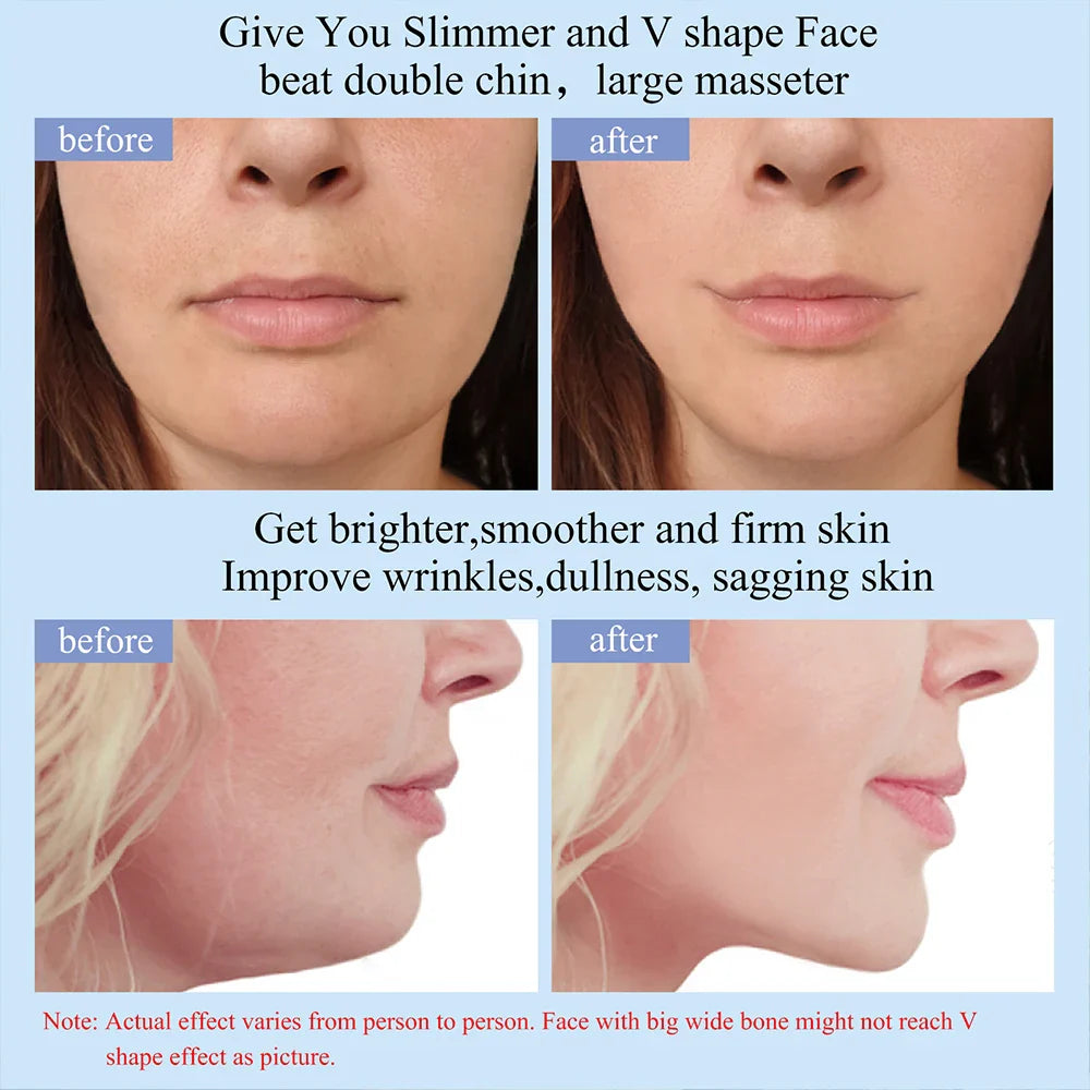 Anton - EMS-lymfmassageapparat